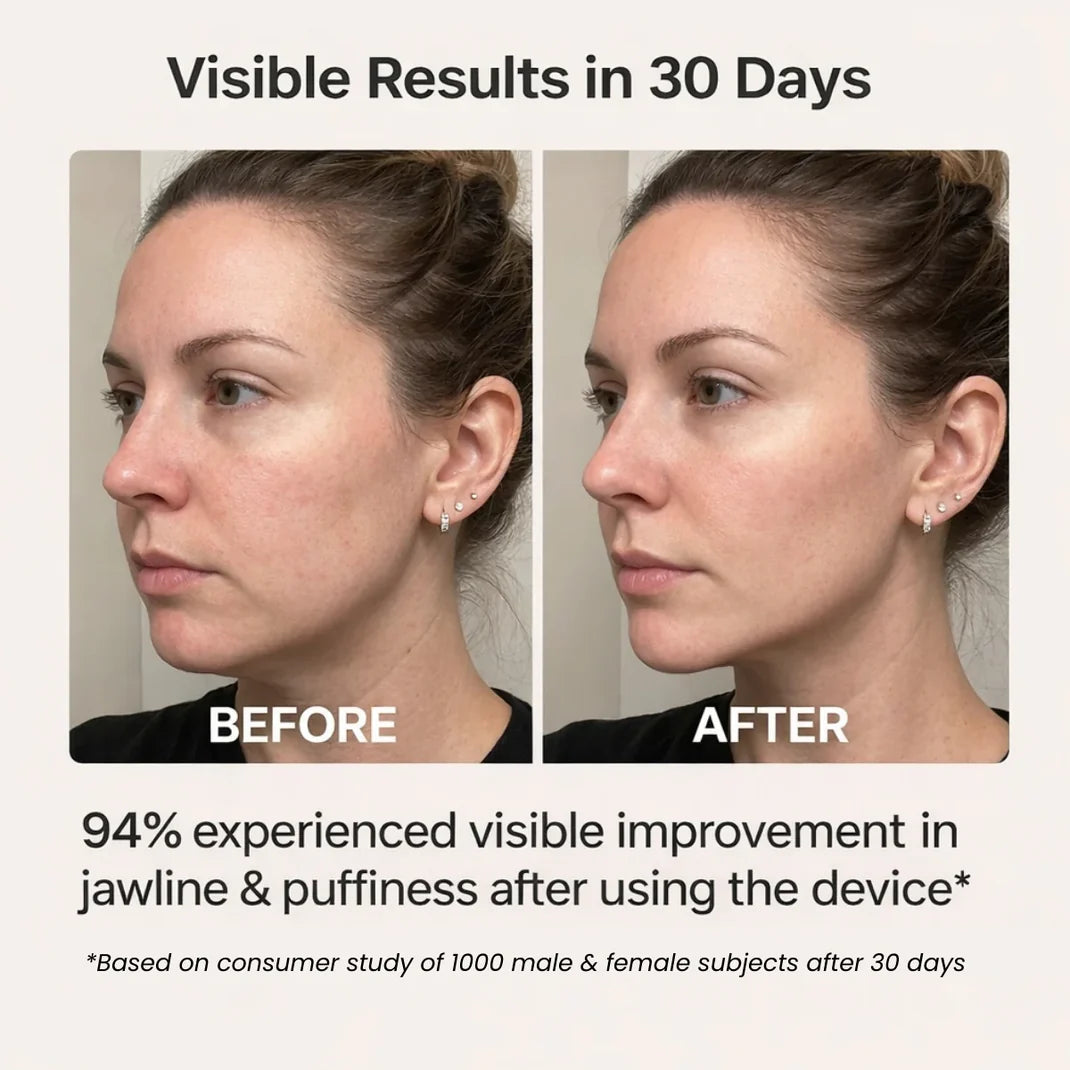 VioraLift V-Line